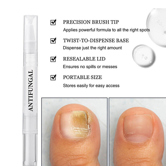 🖤2026 New Year · 40% OFF🖤Toenail Fungus Treatment Pen for Damaged Nails