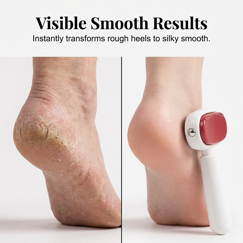 LAST DAY SALE 49% OFF🛒Double-Sided Foot Scraper for Callus Removal