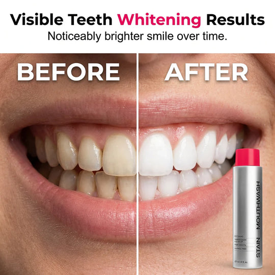 🏆2026 SALE -Advanced Stain-Lifting Whitening Mouthwash: Visible Debris Removal &amp; Fresh Breath