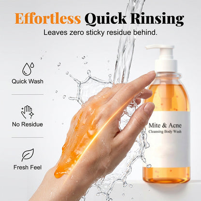 Anti-Mite & Acne Control Body Wash