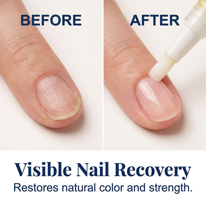 7-Piece Pen &amp; File Set for Discolored Nails