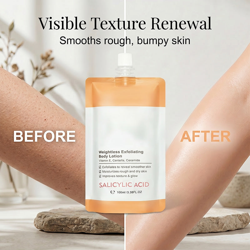 Salicylic Acid Exfoliating Body Lotion Moisturizing Cream