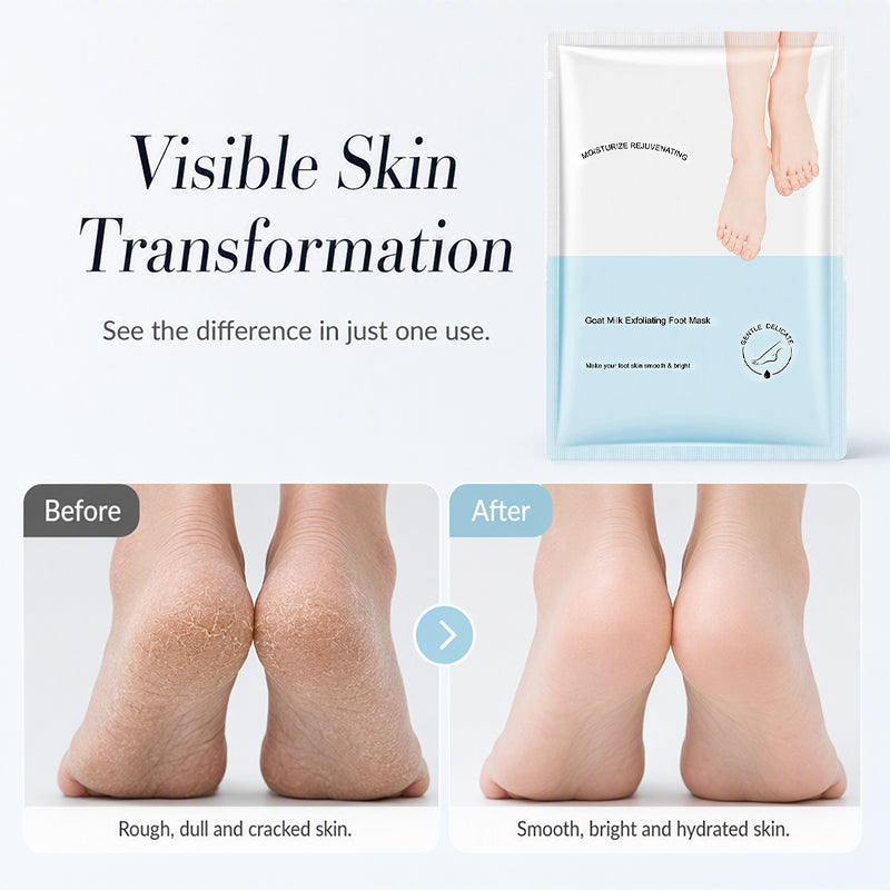 🏠 LIMITED-TIME 50% OFF! ✨Deep Moisture Hand Foot Masks