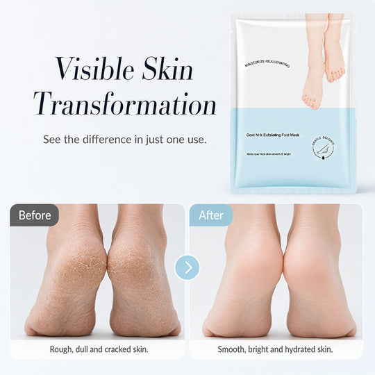 🏠 LIMITED-TIME 50% OFF! ✨Deep Moisture Hand Foot Masks